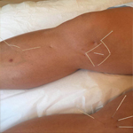 Plants: image 4 0f 4 thumb